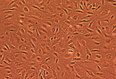 LONZA原代人主动脉内皮细胞HAEC, Human Aortic Endothelial Cells